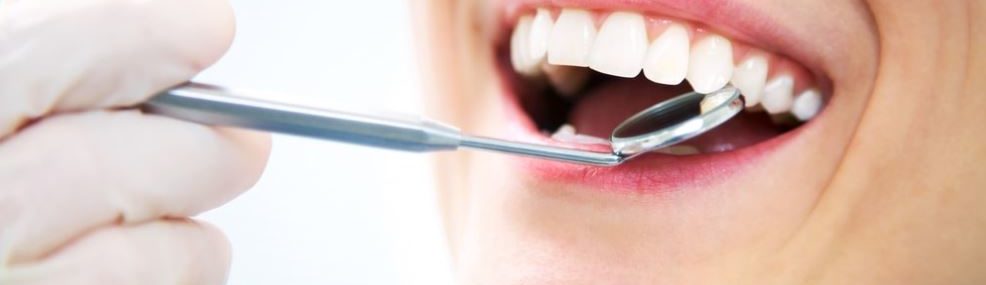 dental checkup
