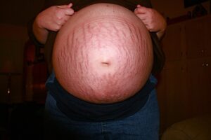 pregnant